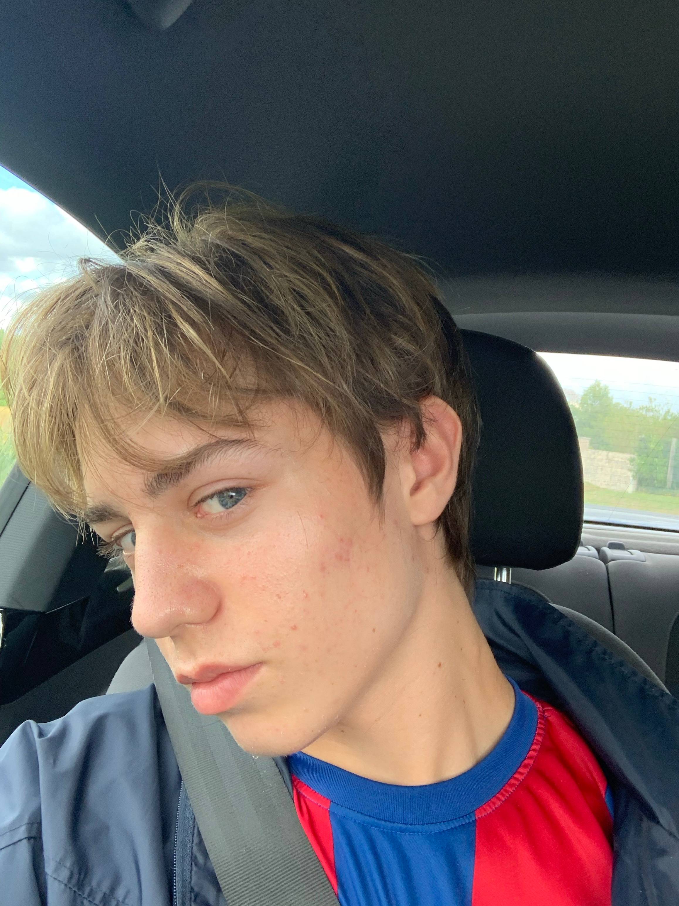 Mathieu